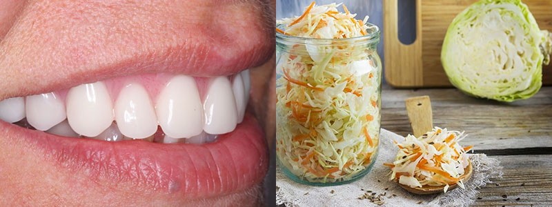 Sauerkraut für Zahnfleisch und Zähne