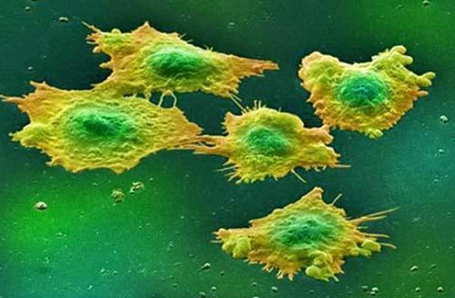 خلايا سرطان